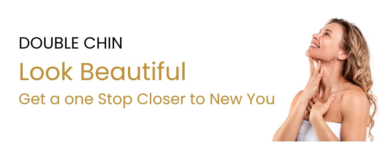 Double Chin